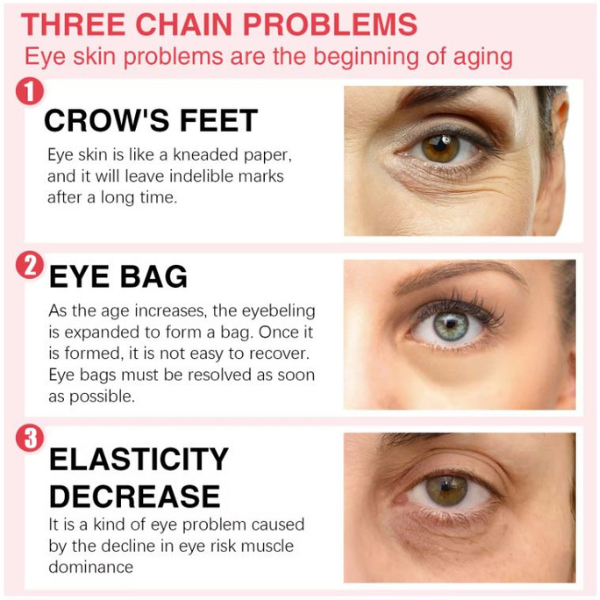 Retinol Eye Stick for eye bag, wrinkles and crow feet. Helps rejuvenate your skin and enhance your confidence without surgery.